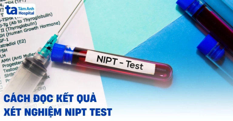 Cách đọc kết quả xét nghiệm NIPT để biết trai hay gái